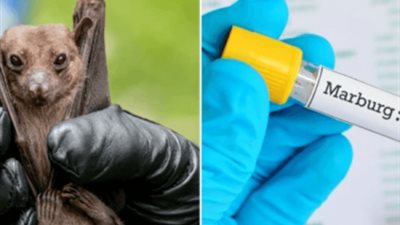 الأكثر فتكًا.. كيف ينتشر فيروس ماربورغ وما أهم أعراضه؟