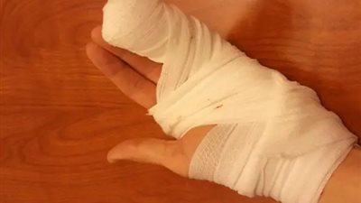 طفل يتعرض لإهمال طبي.. ووالدته: رفضوا يستقبلوه