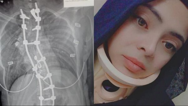 فتاة سورية تتعرض