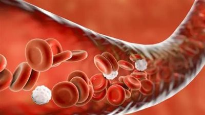 أعراض فقر الدم ونقص الحديد تظهر عند تناول الطعام.. تعرف عليها