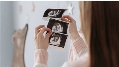 استقر في بطنها لـ 9 سنوات.. جنين متحجر ينهي حياة والدته بنيويورك