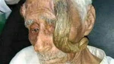 بعد بتر قرنه.. وفاة المعمر اليمني علي عنتر عن عمر يناهز الـ 140 عامًا