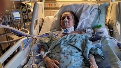 شفاء سيدة من سرطان الرئة النهائي بعد عملية زرع مزدوجة نادرة