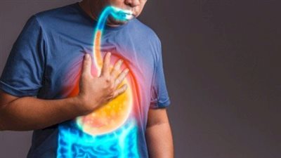 منها الحمل والتدخين.. ما هي أسباب ارتجاع المريء؟