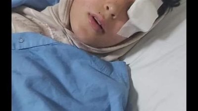 إصابة طفل بسب الألعاب النارية في الدقهلية.. ووالده: ابني عينه راحت