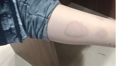 بتنتقم مني في ابني.. سيدة تحرق جسد نجلها لانفصالها عن والده | فيديو