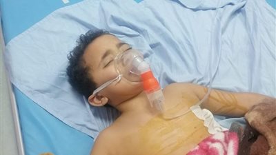 الطفل سيف المصاب بنزيف الرئة يغادر العناية المركزة بعد تحسن حالته الصحية