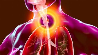 سرطان المريء.. تعرف على الآثار الجانبية للمشروبات الساخنة